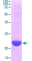 Loading 3 &mu;g protein in 15% SDS-PAGE